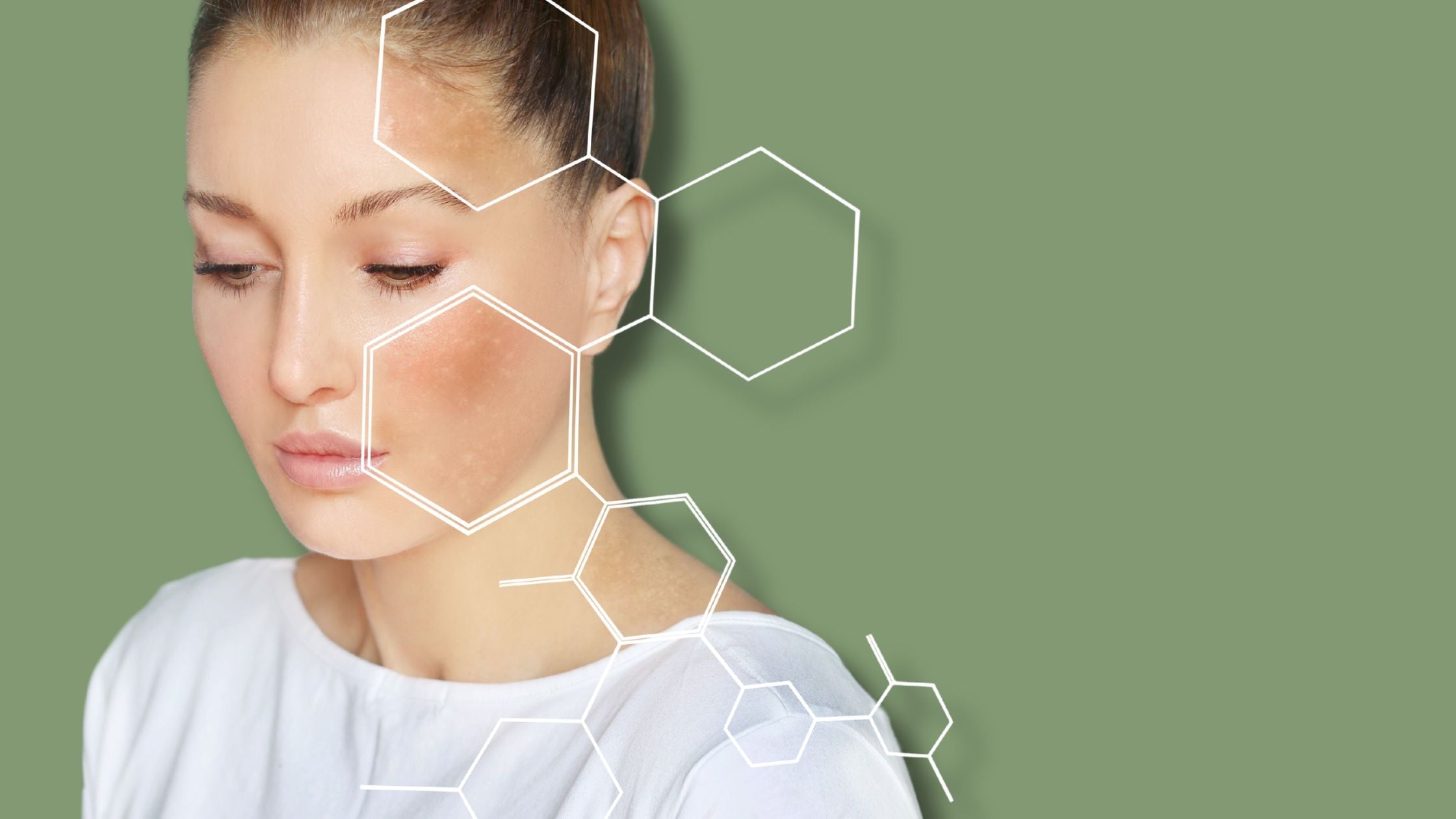 Microbiomul pielii: ce este, cum se schimbă în acnee și are sens analiza microbiomului?